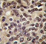 Polyclonal Rabbit anti-Human PKN3 Antibody (aa463-492, IHC, WB)