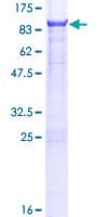 Human PTPN5 / STEP Protein (Recombinant GST)