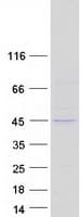 Human RRM2B / P53R2 Protein (Recombinant Myc-DDK (Flag))