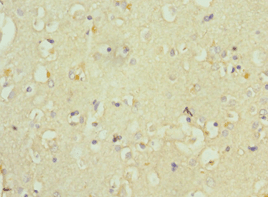 Polyclonal Rabbit anti-Human WC1 / ATP7B Antibody (aa1166-1465, IHC)