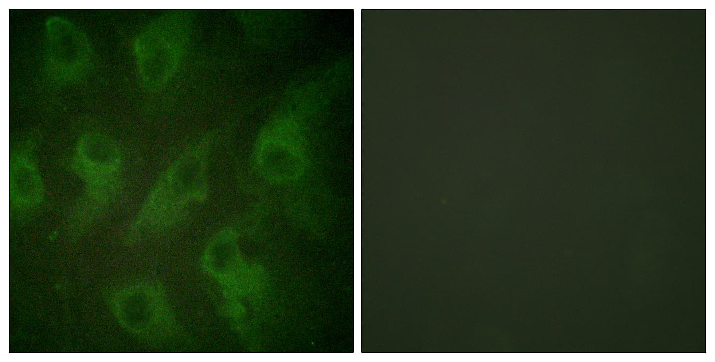IHC-plus™ Polyclonal Rabbit anti-Human KCNJ11 / Kir6.2 Antibody (aa190-239, IHC, IF, WB)