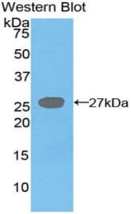 DGAT1 Antibody (aa180-427, APC)