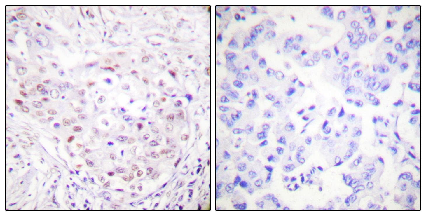 Polyclonal Rabbit anti-Human SENP3 Antibody (IHC, WB)