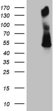 PD-L2 / PDCD1LG2 / CD273 Antibody (clone OTI1B5)