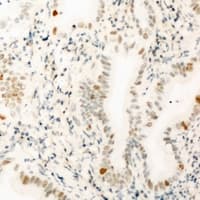 p84 / THOC1 Antibody