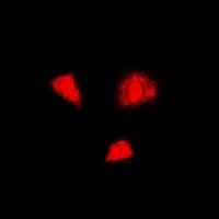 Polyclonal Rabbit anti-Human PSMA6 Antibody (IHC, IF, WB)
