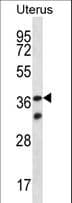 Polyclonal Rabbit anti-Human OR4X2 Antibody (aa276-303, WB)