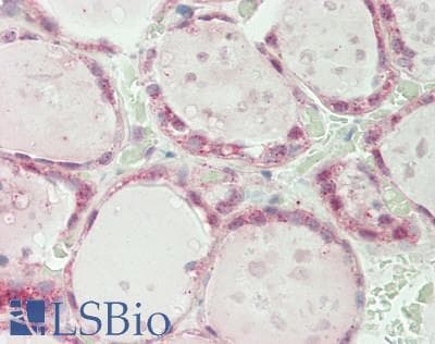SPIN / SPIN1 Antibody (aa179-228)