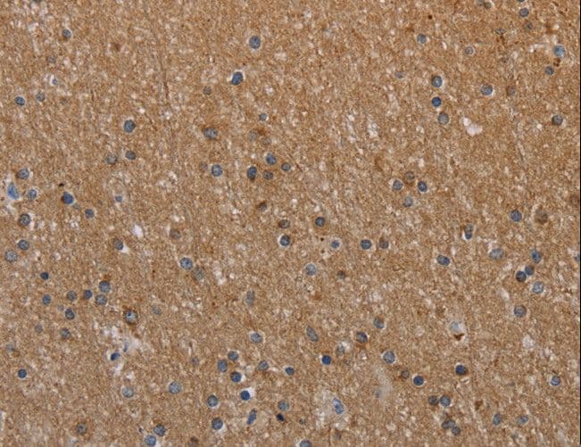 NAA25 Antibody
