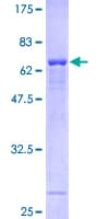 Human PSAT1 Protein (Recombinant GST)