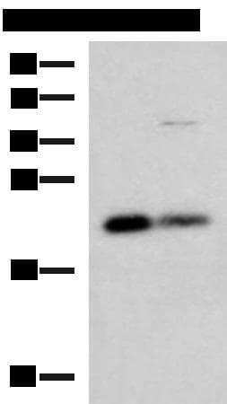 CSRP2 Antibody