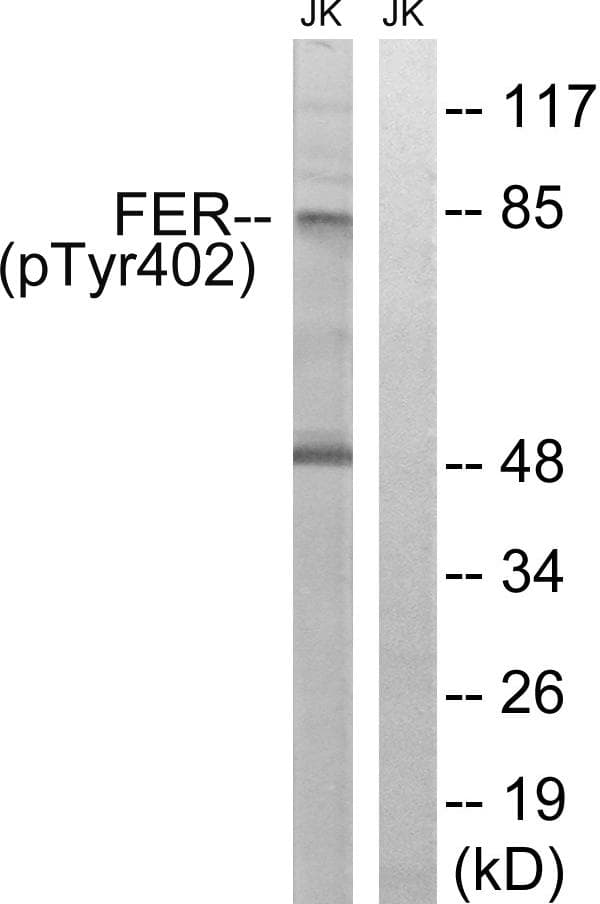 FER Antibody (phospho-Tyr402)