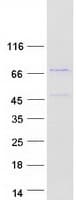 Human ZNF648 Protein (Recombinant Myc-DDK (Flag))
