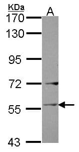 LAD1 Antibody (aa300-517)