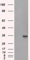 SRR / Serine Racemase Antibody (clone OTI3B5)