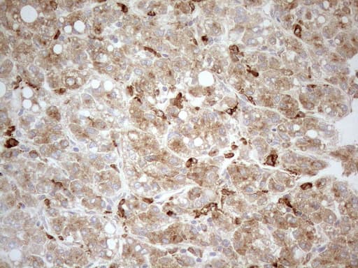 Monoclonal Mouse anti-Human GRN / Granulin Antibody (clone OTI3H6, aa327-593, IHC, WB)