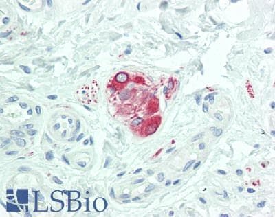 IHC-plus™ Polyclonal Rabbit anti-Human SOS1 Antibody (aa1283-1333, IHC, WB)