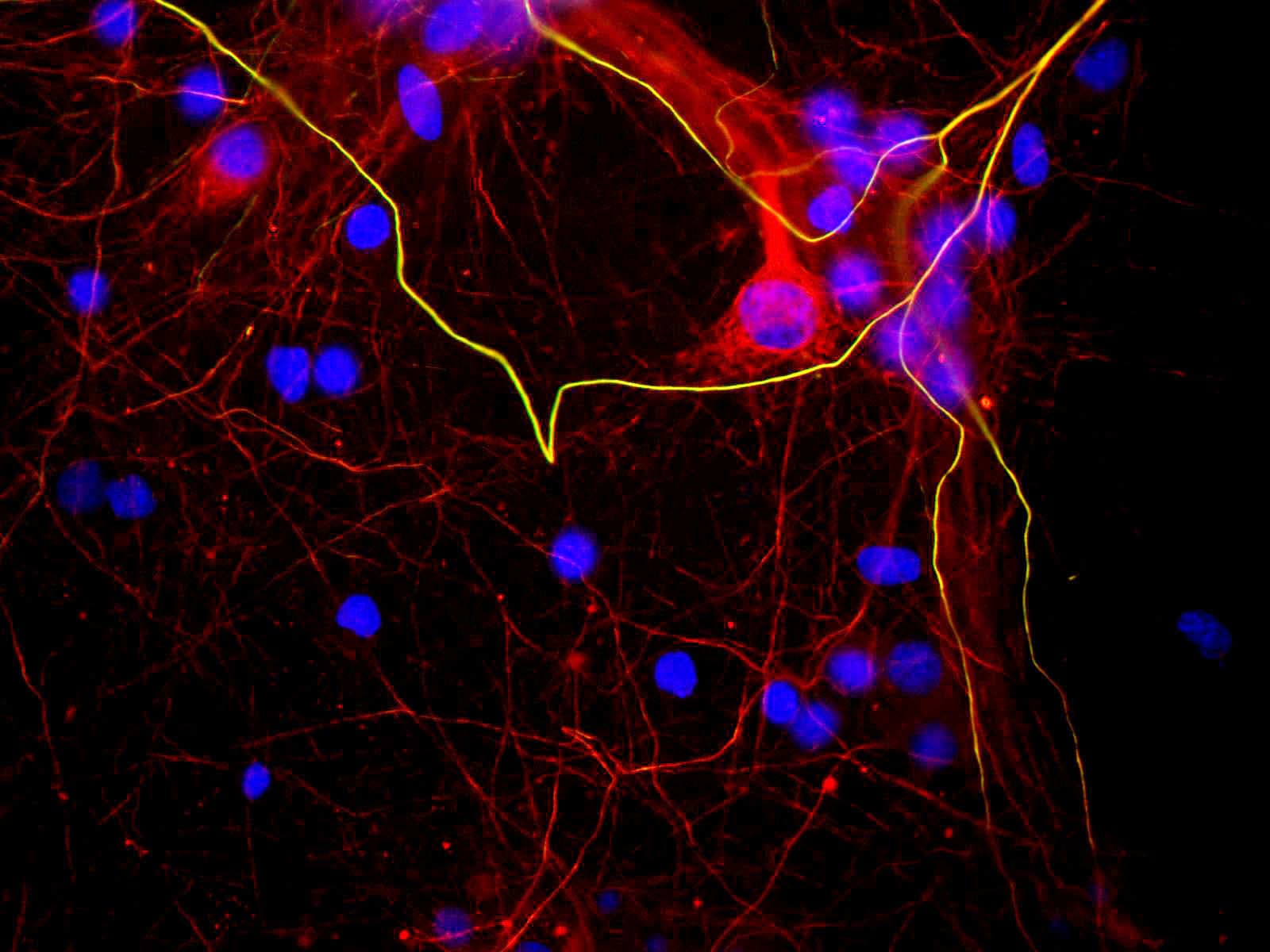 NEFH / NF-H Antibody (clone AH1)