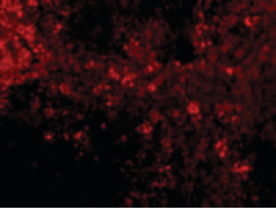 IHC-plus™ Polyclonal Rabbit anti-Human IRF7 Antibody (IHC, IF, WB)