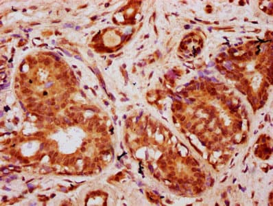 HIST1H2BN Antibody