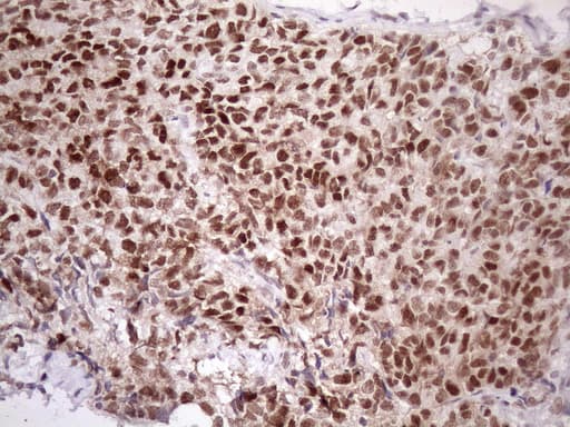 ATF1 Antibody (clone OTI2B4)