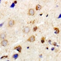 PPP1R12A / MYPT1 Antibody (Internal)