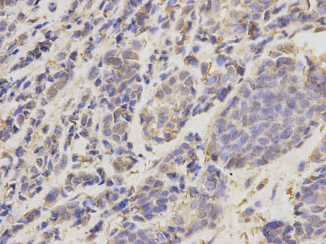 IHC-plus™ UBE2I / UBC9 Antibody