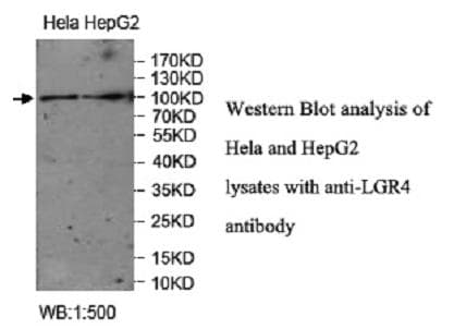 Polyclonal Rabbit anti-Human GPR48 / LGR4 Antibody (C-Terminus, WB)