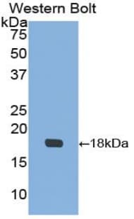 Polyclonal Rabbit anti-Human IGFBP3 Antibody (aa135-277, WB)