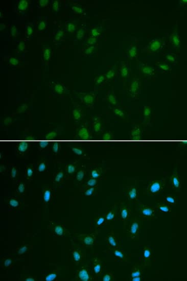 HSF2 Antibody
