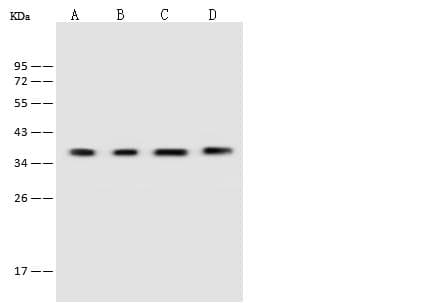 Polyclonal Rabbit anti-Human VTA1 Antibody (IF, WB)