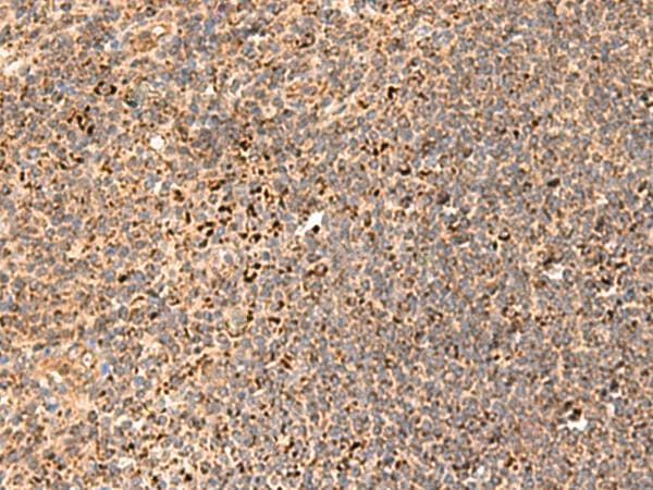 REG1B Antibody