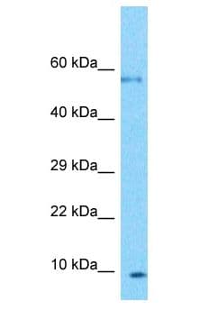 PLGLB2 / PLGLB1 Antibody (aa31-80)