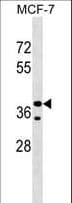 Polyclonal Rabbit anti-Human CCBE1 Antibody (aa163-191, WB)