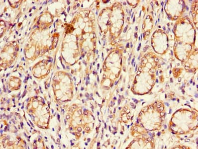 Polyclonal Rabbit anti-Human CDKN2B / p15 INK4b Antibody