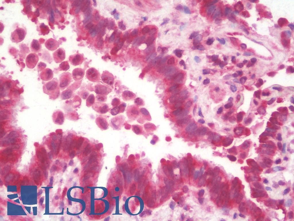 IHC-plus™ MRPL13 Antibody (aa121-170)