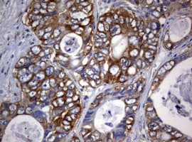 Monoclonal Mouse anti-Human PIK3C2A Antibody (clone OTI2D9, aa230-560, IHC, WB)