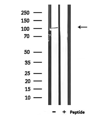DLG1 / SAP97 Antibody