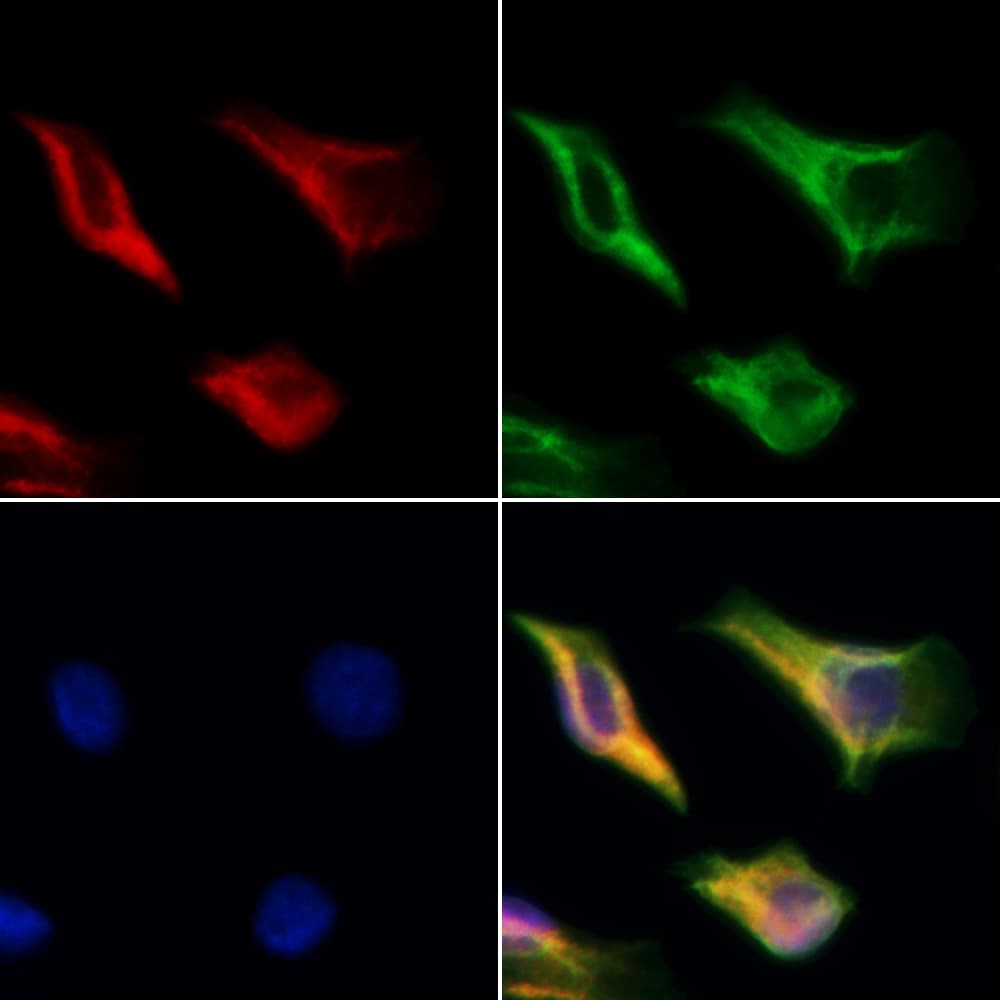 Polyclonal Rabbit anti-Human DARS2 Antibody (IF, WB)