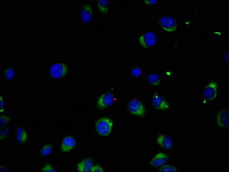 MAK Antibody