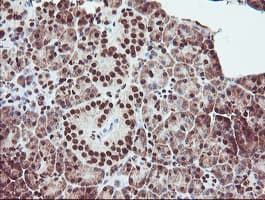 EXOSC7 Antibody (clone OTI1G8)