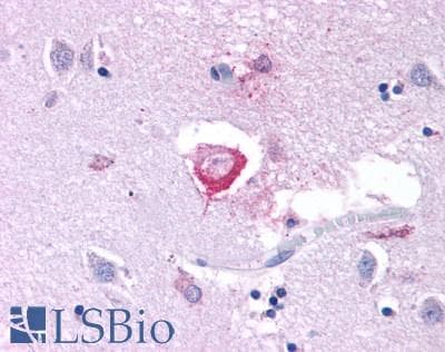 PathPlus™ GRM3 / MGLUR3 Antibody (N-Terminus)