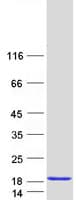 Human CALML3 Protein (Recombinant Myc-DDK (Flag))