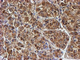 PSMB9 Antibody (aa21-219, clone OTI1D1)
