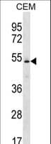 KCNJ4 / Kir2.3 Antibody (aa1-30)