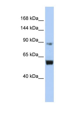 Polyclonal Rabbit anti-Human MCM10 Antibody (aa648-697, WB)