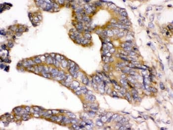 WNK1 Antibody
