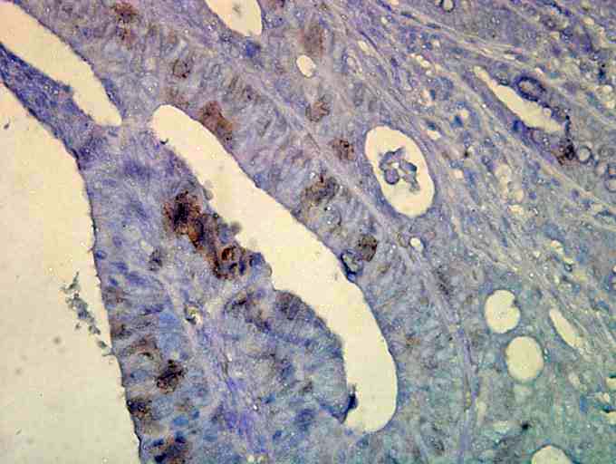 Monoclonal Mouse anti-Human HSP70 / Heat Shock Protein 70 Antibody (clone C92F3A-5, IHC, WB)