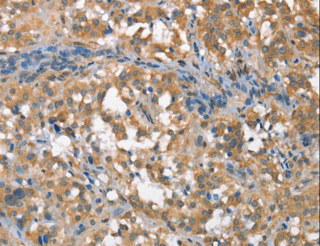 Polyclonal Rabbit anti-Human CSMD1 Antibody (IHC)