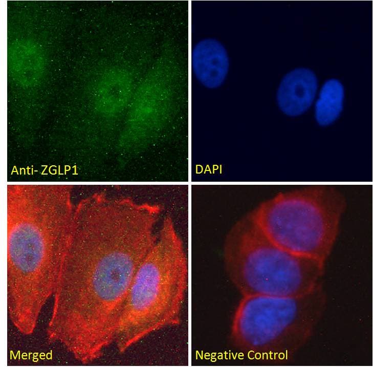 ZGLP1 Antibody (aa145-157)